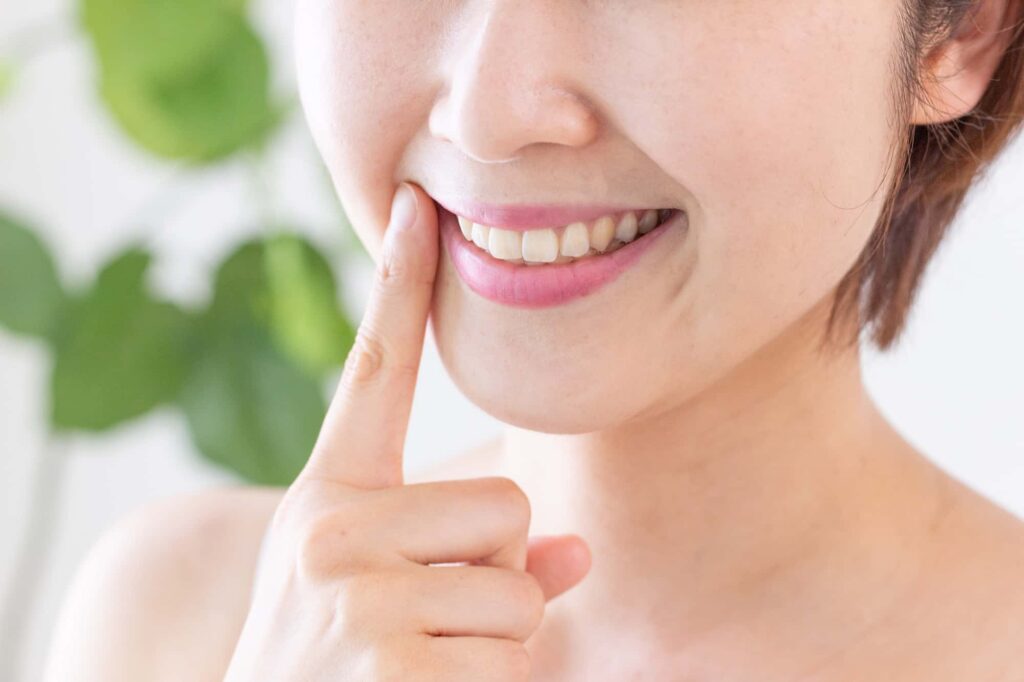 ホワイトニングをした美しい白い歯のイメージ