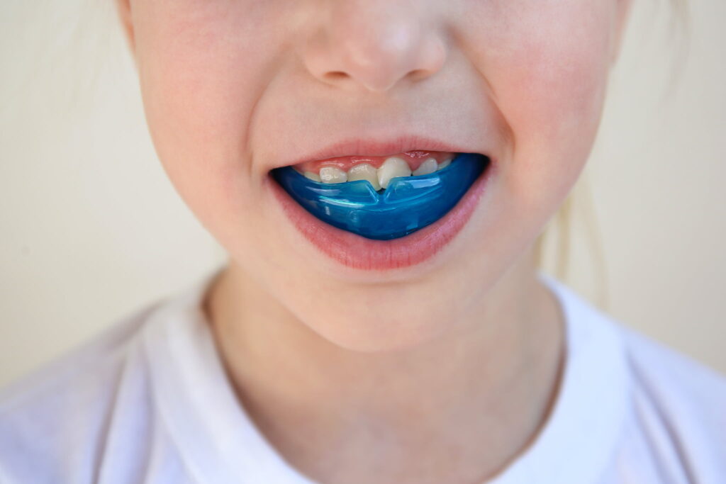 プレオルソを装着した口のイメージ