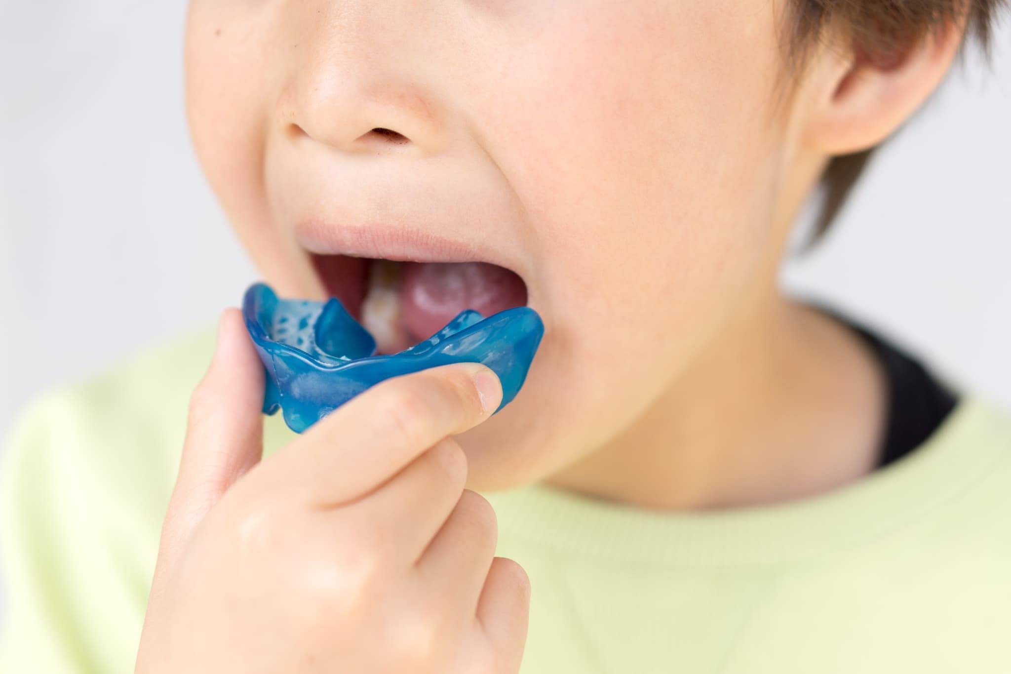 プレオルソを装着しようとしている子ども