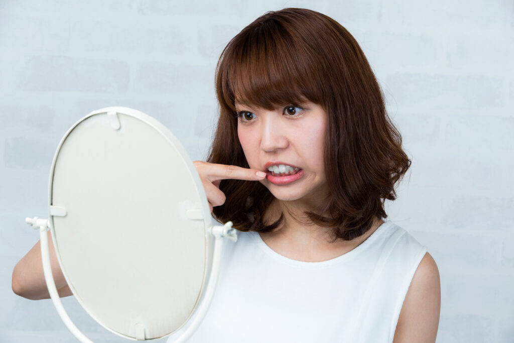 前歯の歯並びが気になる女性