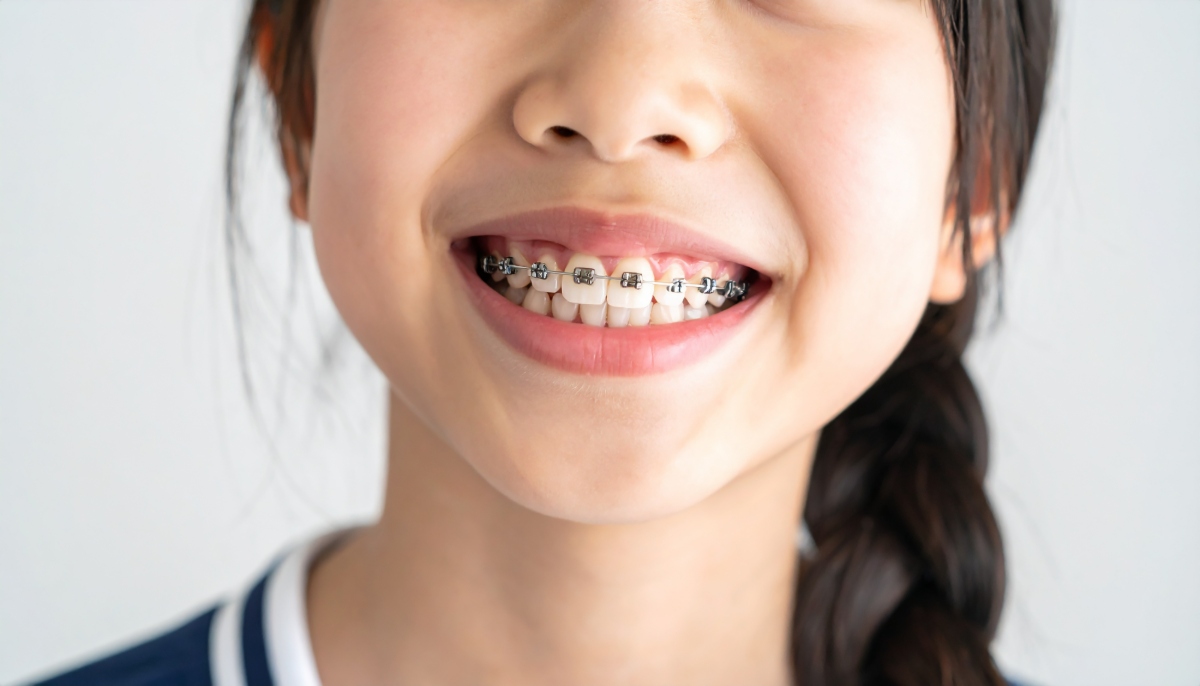 2期の小児矯正をしている子ども